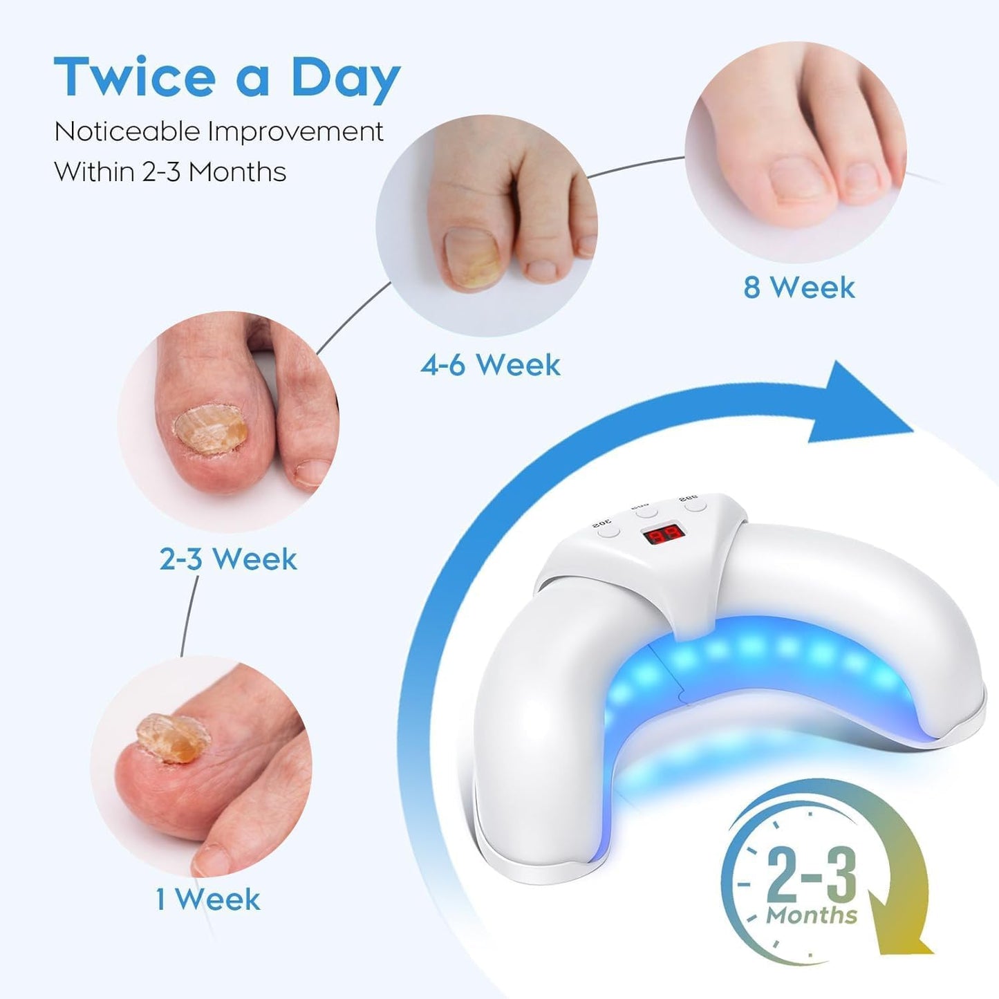 FungGone™ - LED Therapy Nail Fungus Device