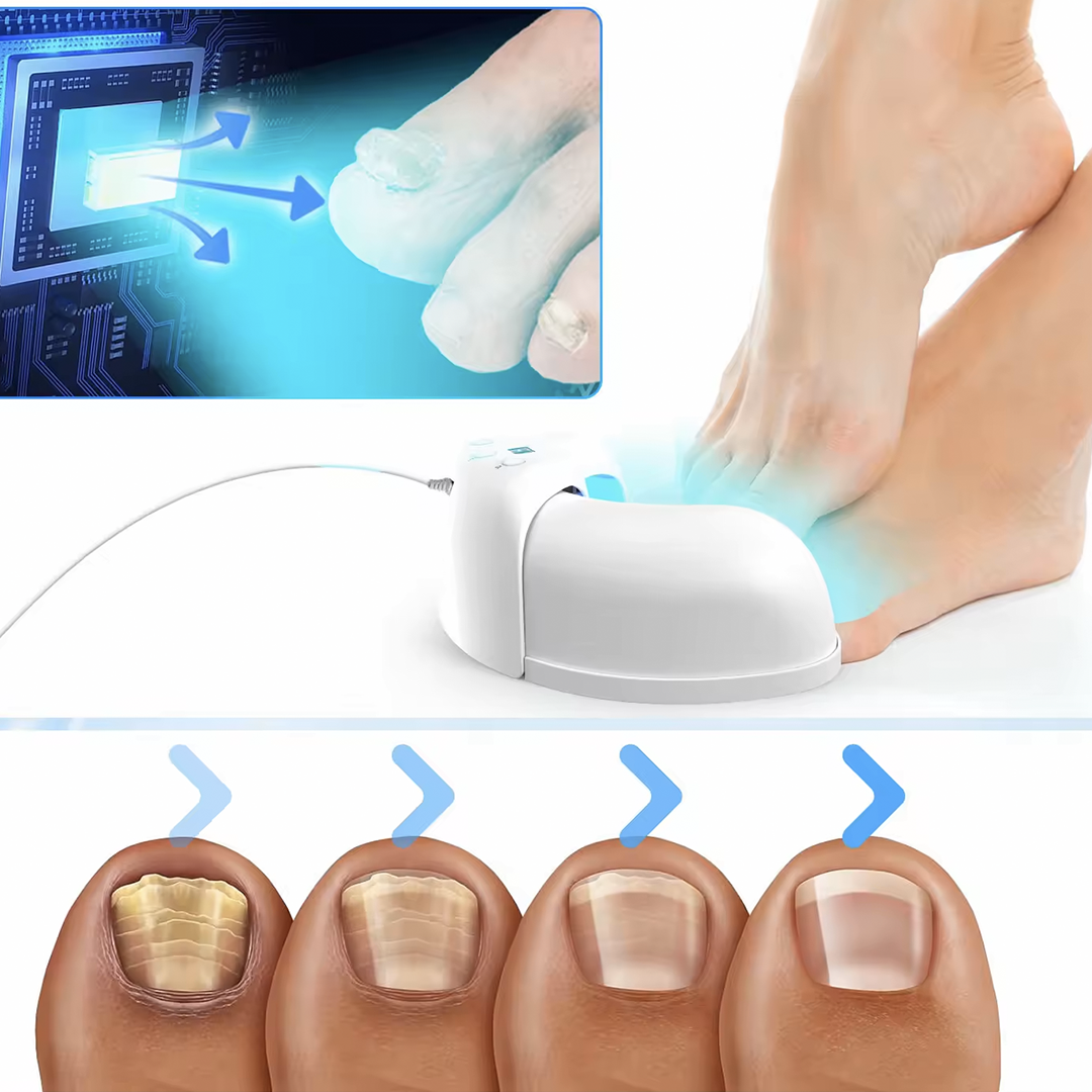 FungGone™ - LED Therapy Nail Fungus Device