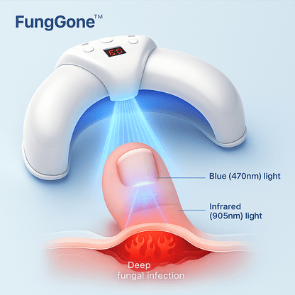 FungGone™ - LED Therapy Nail Fungus Device